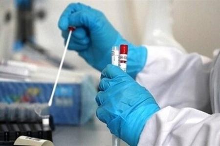 اعلام فهرست آزمایشگاه های تشخیص کووید 19 اعلام لیست آزمایشگاه های تشخیص کووید 19