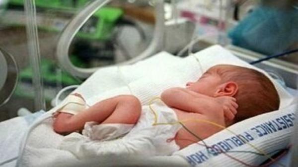 افزایش 16 تخت مراقبت های ویژه نوزادان در بیمارستان های کرمانشاه